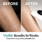 Professionelles IPL-Laser-Haarentfernungsgerä